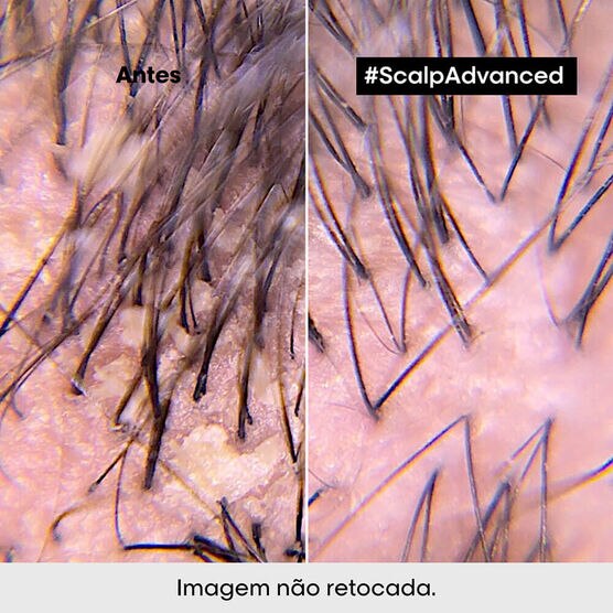 Serie Expert Scalp Shmp Antidandruff